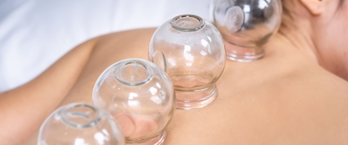 Cupping massage Prudhoe